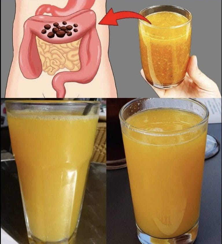 A healthy colon plays a vital role in overall wellness, aiding digestion, nutrient absorption, and waste elimination. A natural colon cleanse can help remove toxins, improve gut health, and boost energy levels. If you're looking for a simple, effective recipe to cleanse your colon, try this easy homemade remedy.